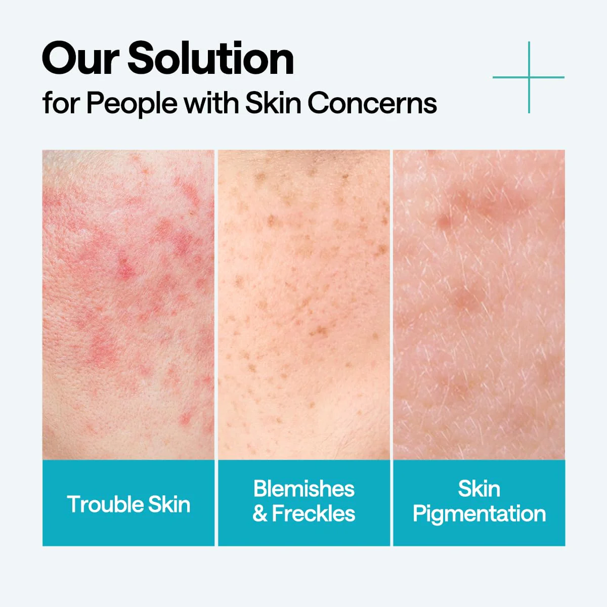 Madecassoside Blemish Repair Serum - Image 4