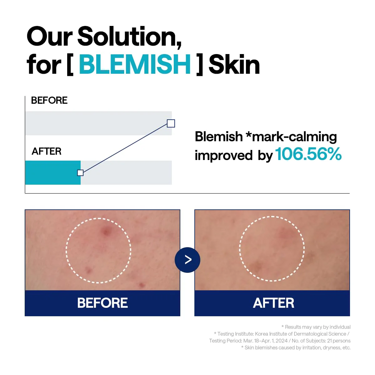Madecassoside Blemish Repair Serum - Image 7