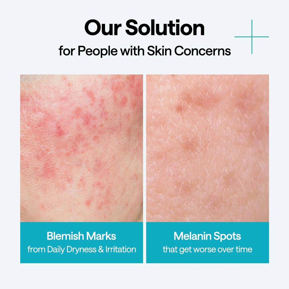 Mediheal Madecassoside Wrapping Serum Mask - Image 7
