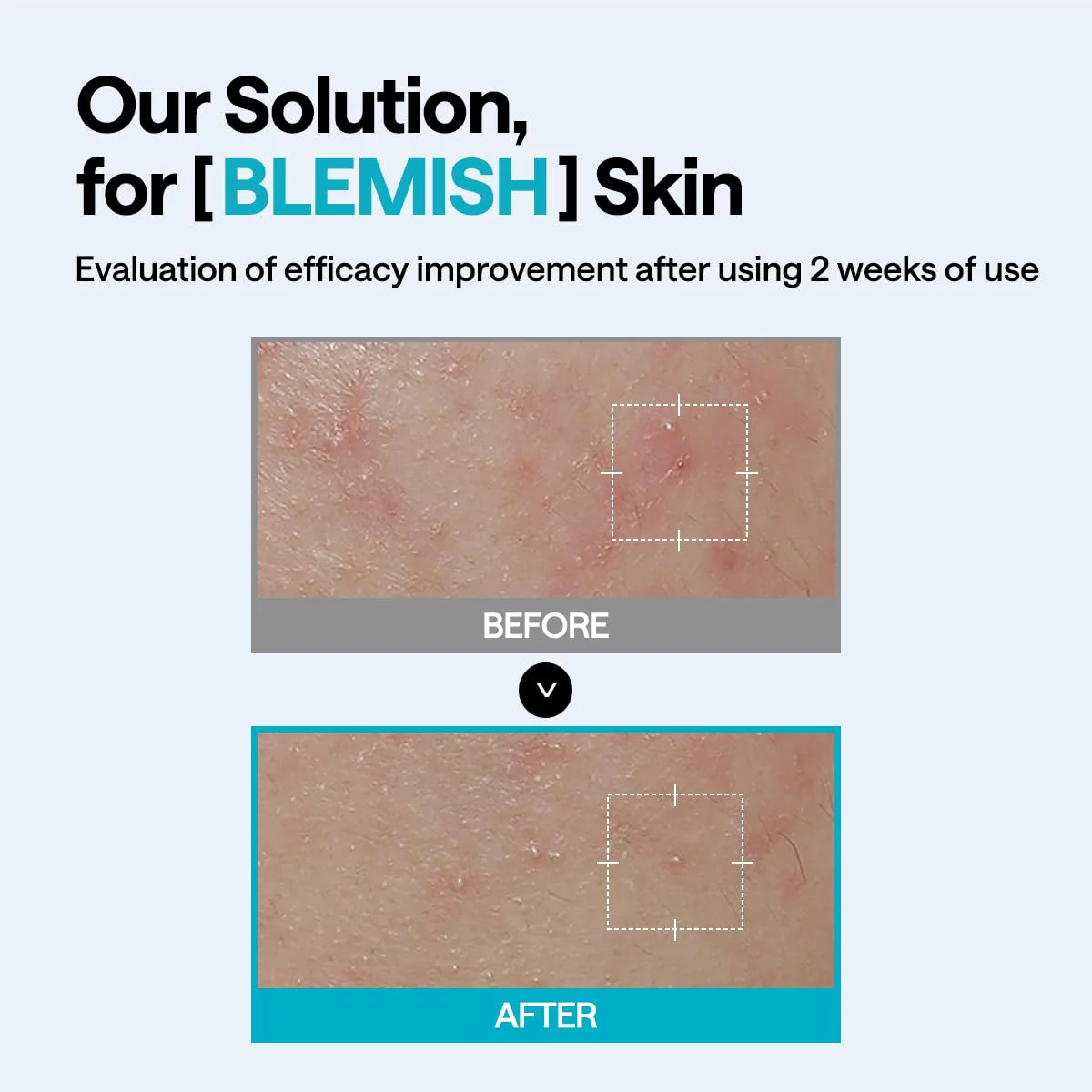 Mediheal Madecassoside Wrapping Serum Mask - Image 8