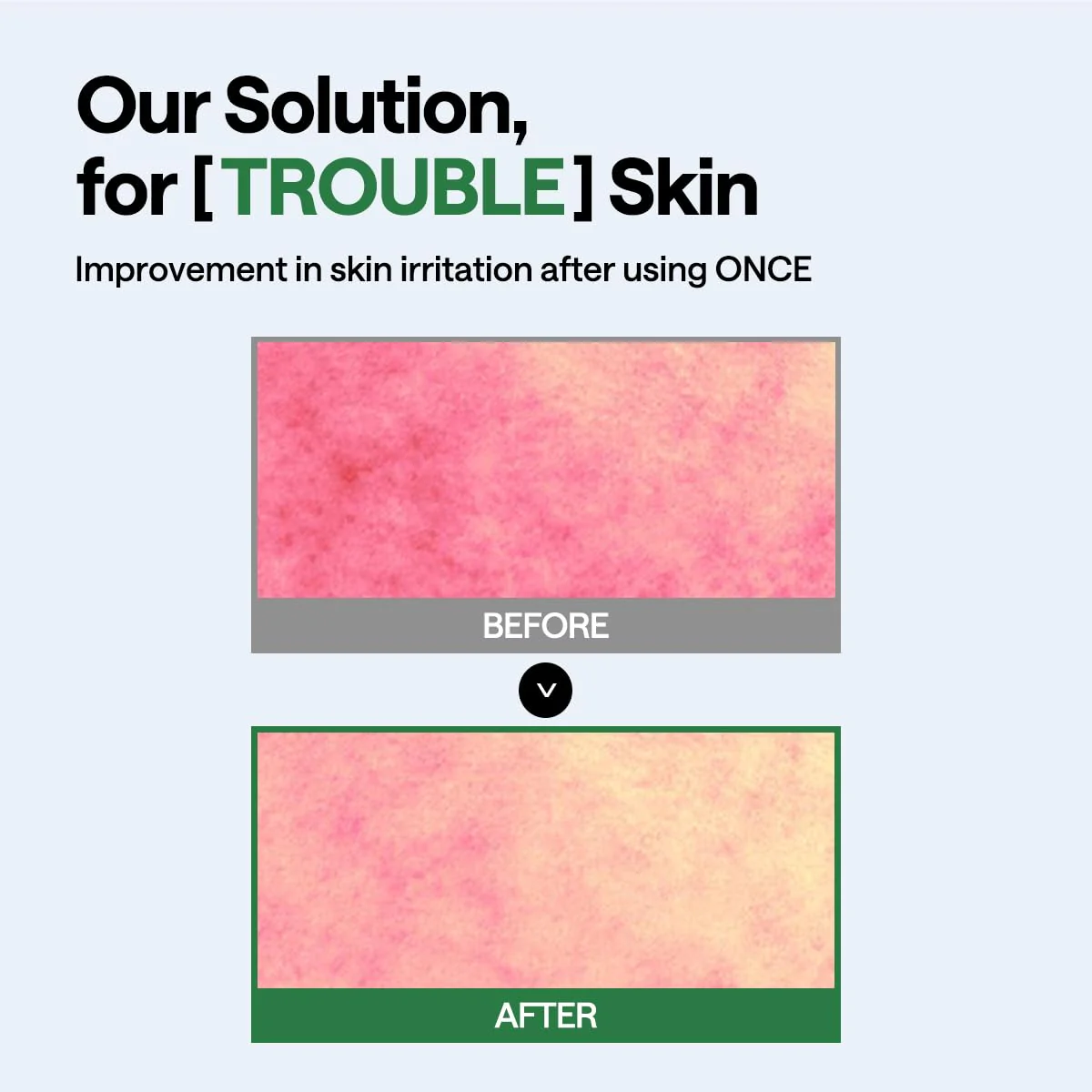 Teatree Wrapping Serum Mask - Image 5