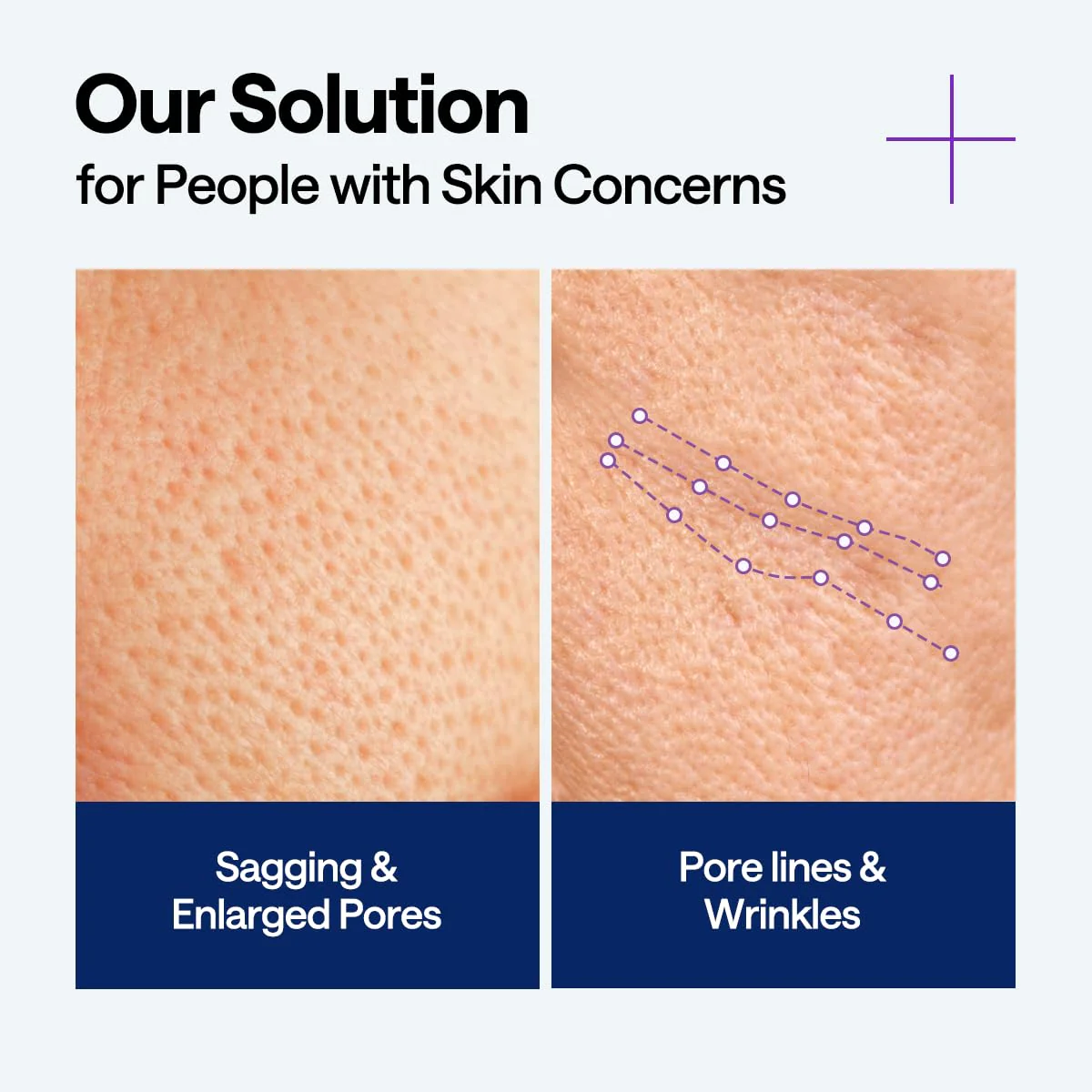PDRN Lifting Serum - Image 4