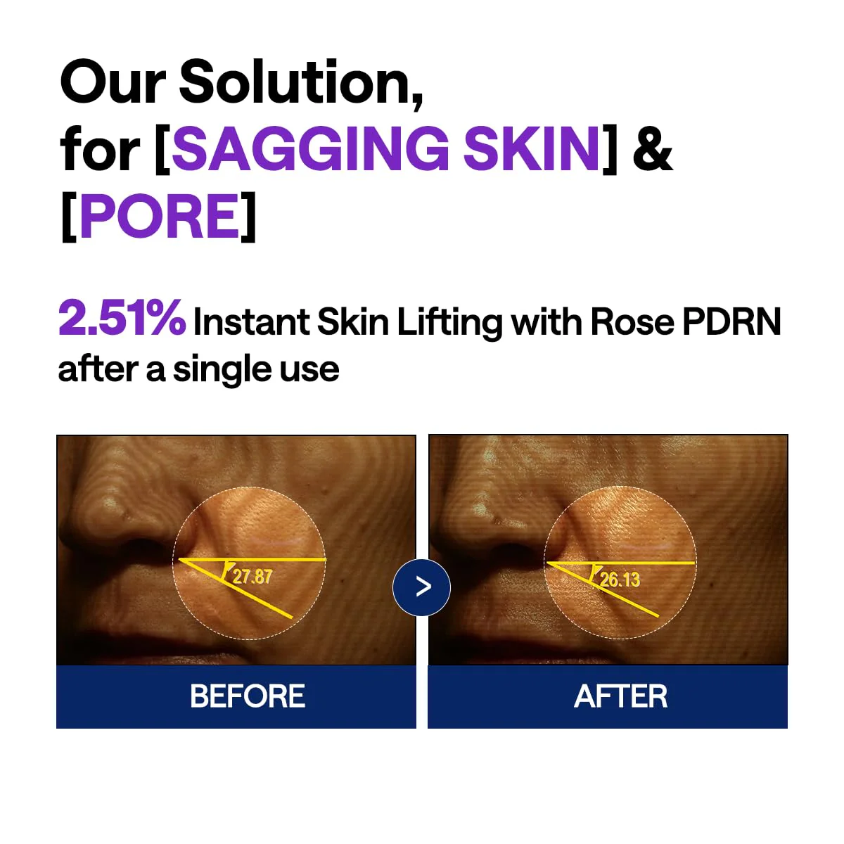PDRN Lifting Serum - Image 8