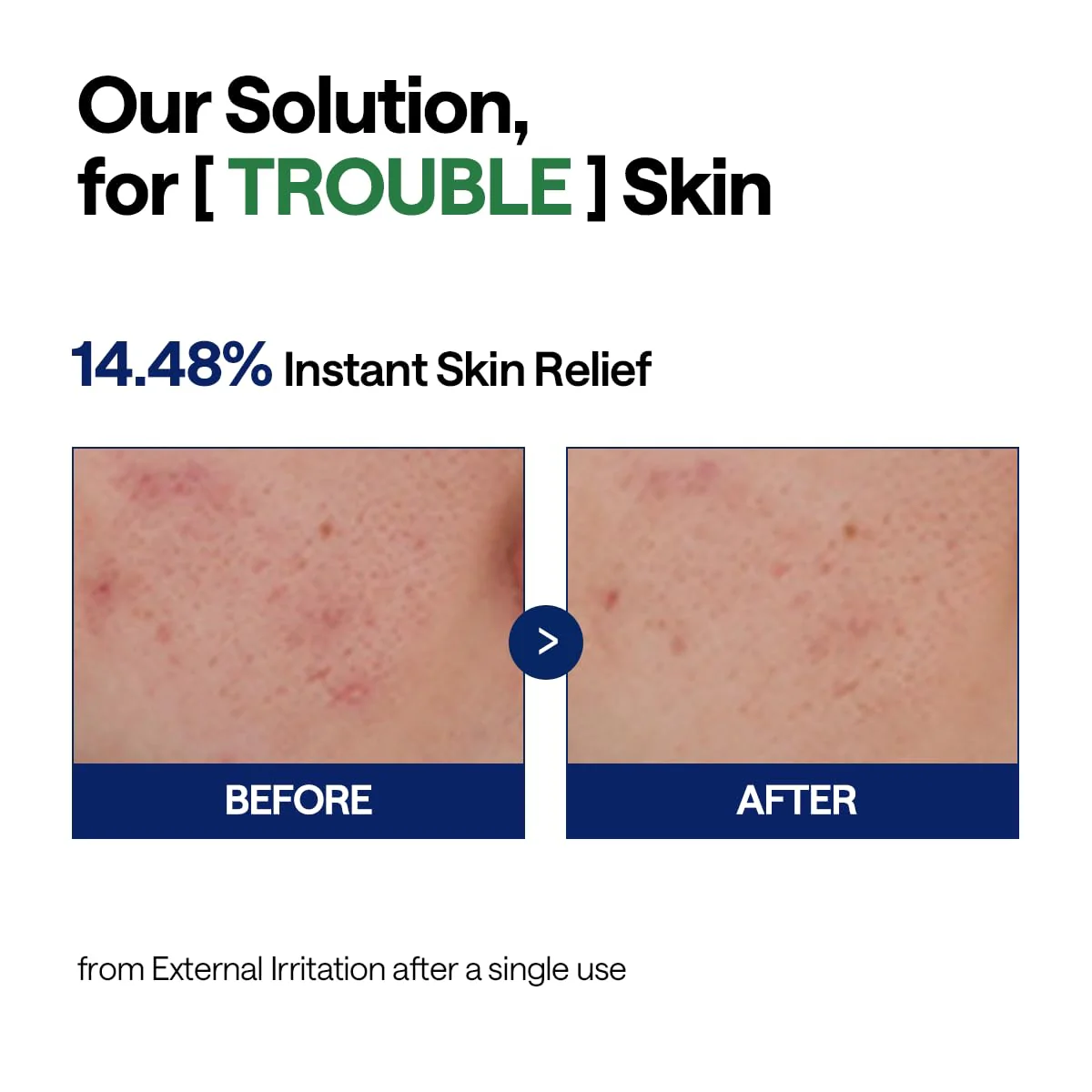 Teatree Calming Hydra Serum - Image 6