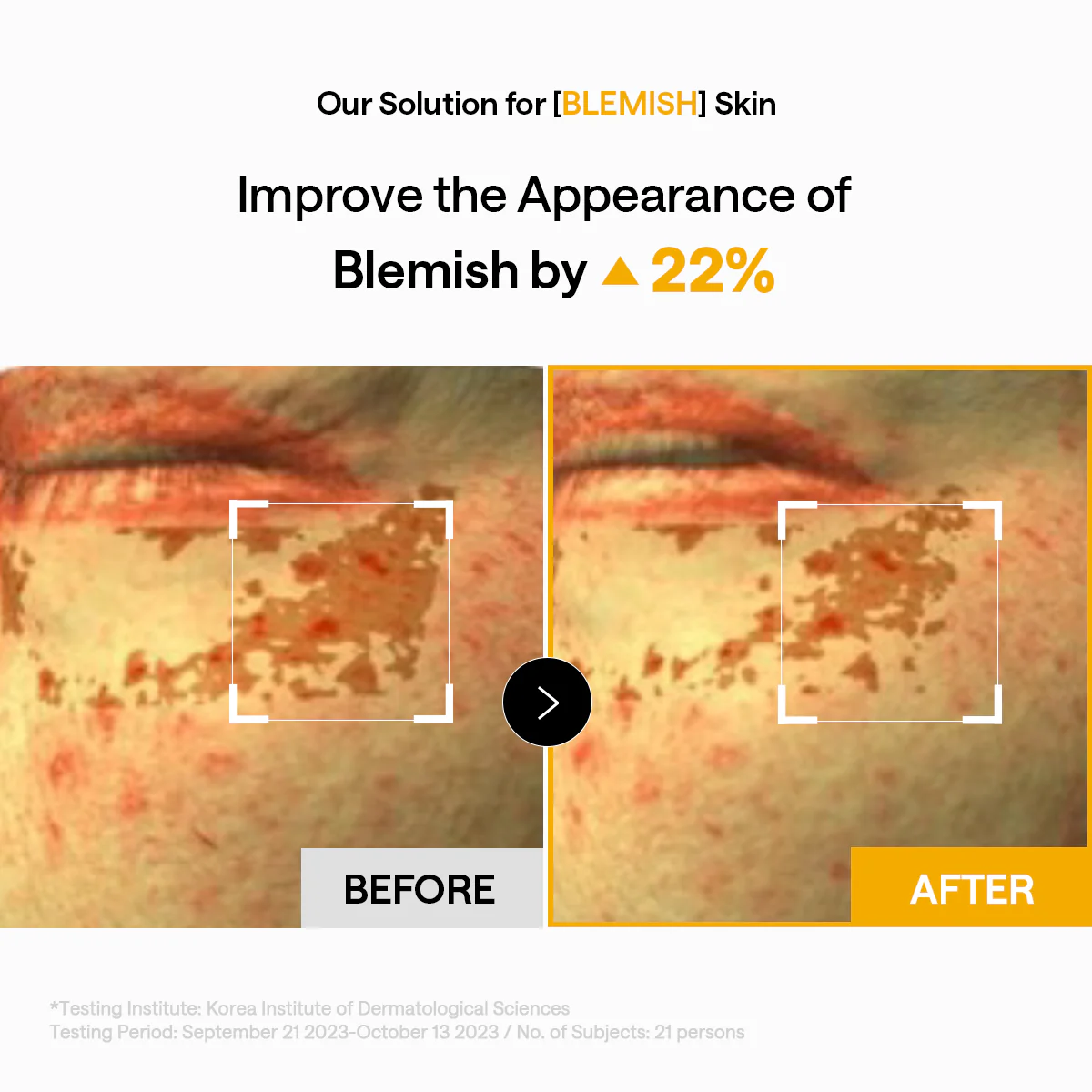 Vita Collagen Eye Ampoule Patch - Image 5